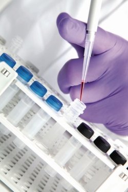 Nucleotide Extraction System 50rxn | Description : Nucleotide Extraction System 50rxn